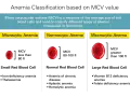 Porównanie wielkości krwinek czerwonych w anemii: mikrocytarna (małe), normocytarna (normalne) i makrocytarna (duże). MCV pomaga w diagnozie.