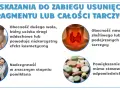 Ilustracja przedstawia schemat tarczycy, powiększone wole, lekarza badającego pacjentkę i tabletki.