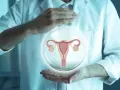 Dłonie lekarza w białym fartuchu trzymają bańkę z grafiką narządów rodnych kobiety.