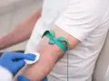 Ręka pacjenta z opaską uciskową i wacikiem przygotowywana do pobrania krwi na badanie HBs antygen.