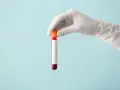Ręka w białej rękawiczce trzyma probówkę z czerwoną próbką krwi, gotową do analizy, która może wykazać poziom immunoglobuliny.