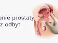 Ilustracja anatomiczna męskiego układu rozrodczego z palcem w rękawiczce badającym prostatę przez odbyt.
