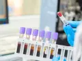 Ręce w niebieskich rękawiczkach trzymają probówki z krwią w stojaku, w tle sprzęt laboratoryjny.