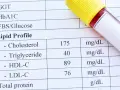 Wynik lipidogramu: cholesterol całkowity 175, triglicerydy 40, HDL-C 89, LDL-C 76. Wynik ten pomaga ocenić ryzyko chorób serca, analizując cholesterol nie-HDL.