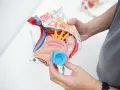 Model anatomiczny narządów miednicy z pessarem w ręku.