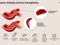 Ilustracja porównuje prawidłowy i niski poziom hemoglobiny, pokazując zdrowe krwinki i te o zmienionym kształcie. Objawy niskiej hemoglobiny to m.in. ból głowy.