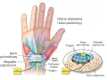 Ilustracja anatomiczna dłoni i nadgarstka z zaznaczonym nerwem pośrodkowym i więzadłem poprzecznym.