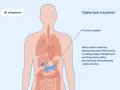 Ilustracja anatomiczna przedstawiająca ludzkie ciało z zaznaczoną trzustką i opisem bólu.