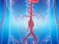 Anatomia aorty brzusznej z widocznym tętniakiem.