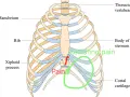 Anatomia klatki piersiowej z zaznaczonym wyrostkiem mieczykowatym i obszarem bólu.