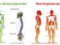 Prawidłowe ułożenie kości krzyżowej zapewnia stabilność kręgosłupa. Po prawej widać skrzywienie, gdzie kość krzyżowa jest przechylona.