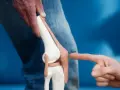 Model anatomiczny kolana, na który wskazuje palec, na tle niebieskim.