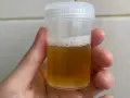 Dłoń trzymająca plastikowy pojemnik z żółtym płynem i pianą na wierzchu.