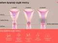 Ilustracja przedstawia trzy stadia dysplazji szyjki macicy: I, II i III stopień, z zaznaczonymi objawami.