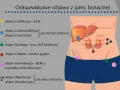 Ilustracja przedstawia schemat jamy brzusznej z zaznaczonymi organami i punktami odpowiadającymi objawom chorobowym.