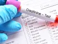 Rękawiczka w niebieskiej rękawiczce trzyma probówkę z napisem "Creatinine - Test". Zaznaczono pole "Creatinine", sugerując niski poziom kreatyniny.