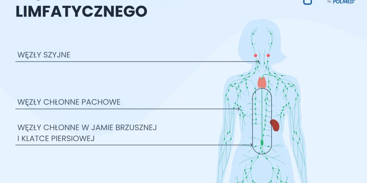Ilustracja schematyczna układu limfatycznego człowieka z zaznaczonymi węzłami chłonnymi.