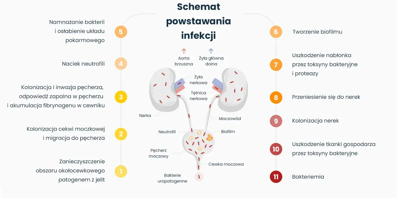 Schemat powstawania infekcji układu moczowego z zaznaczonymi nerkami, pęcherzem i cewką moczową.