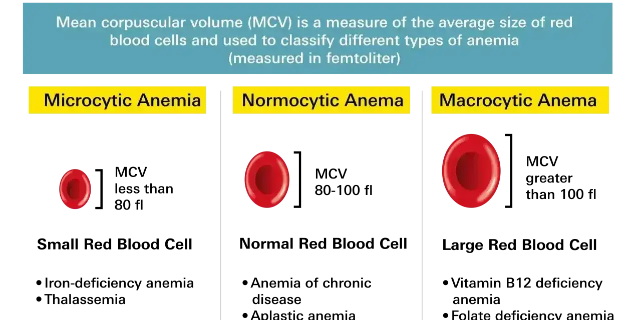 Porównanie wielkości krwinek czerwonych w anemii: mikrocytarna (małe), normocytarna (normalne) i makrocytarna (duże). MCV pomaga w diagnozie.