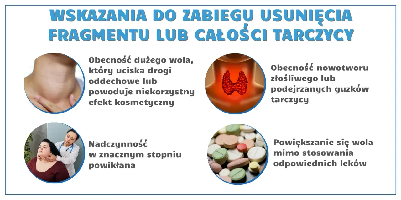 Ilustracja przedstawia schemat tarczycy, powiększone wole, lekarza badającego pacjentkę i tabletki.