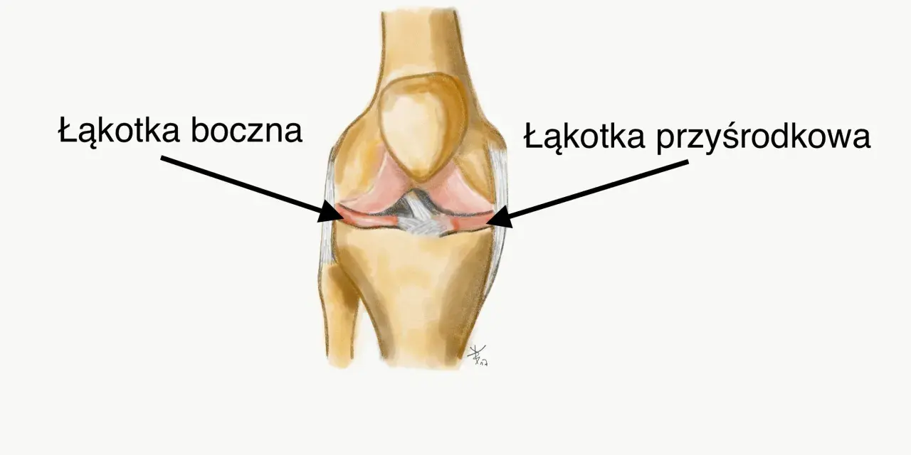 Ilustracja anatomiczna stawu kolanowego z zaznaczonymi łąkotkami: boczną i przyśrodkową.
