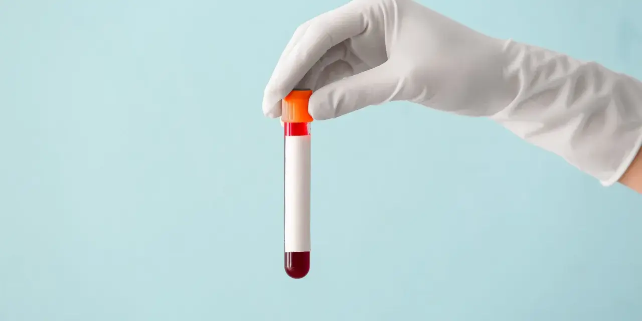 Ręka w białej rękawiczce trzyma probówkę z czerwoną próbką krwi, gotową do analizy, która może wykazać poziom immunoglobuliny.
