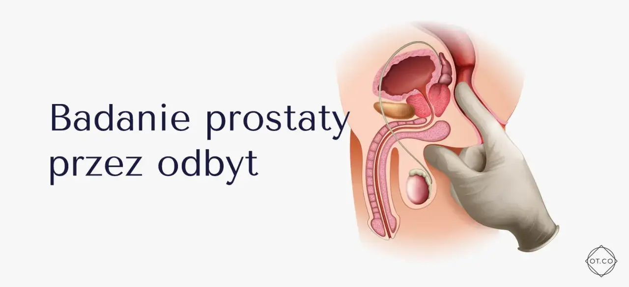 Ilustracja anatomiczna męskiego układu rozrodczego z palcem w rękawiczce badającym prostatę przez odbyt.