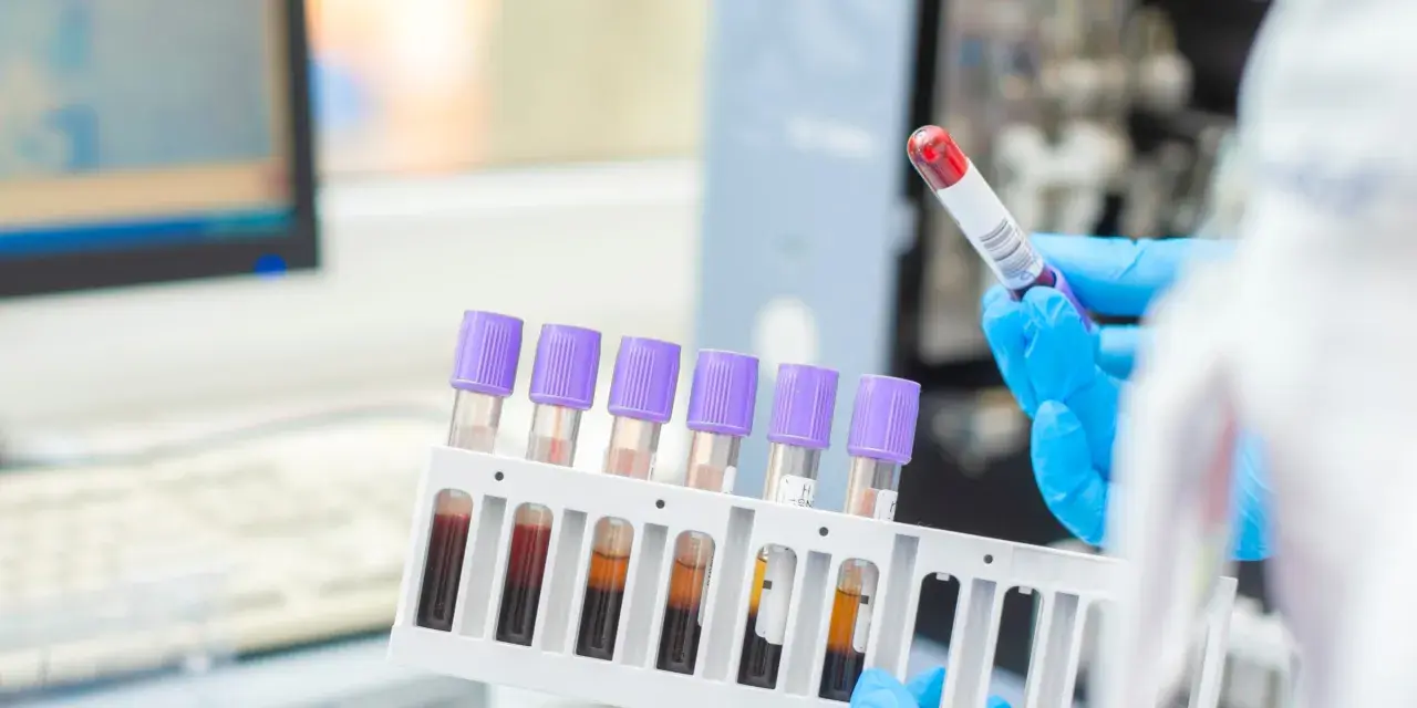 Ręce w niebieskich rękawiczkach trzymają probówki z krwią w stojaku, w tle sprzęt laboratoryjny.