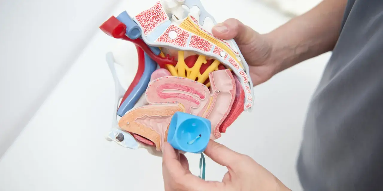 Model anatomiczny narządów miednicy z pessarem w ręku.