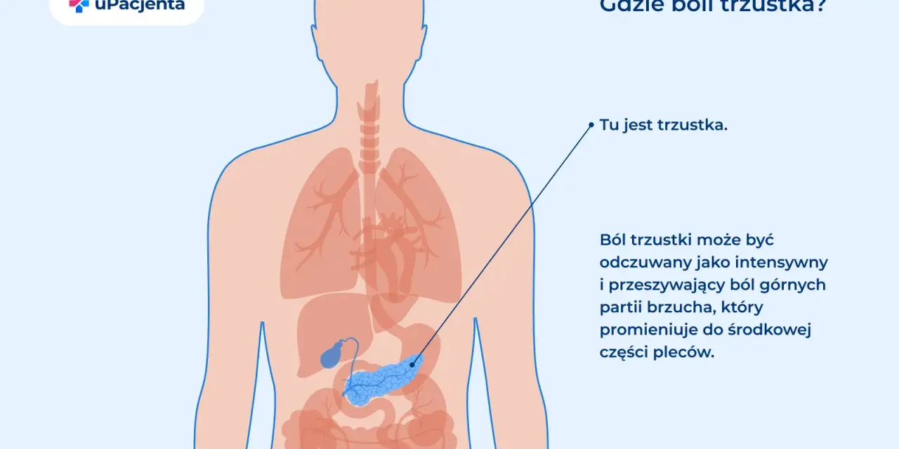Ilustracja anatomiczna przedstawiająca ludzkie ciało z zaznaczoną trzustką i opisem bólu.