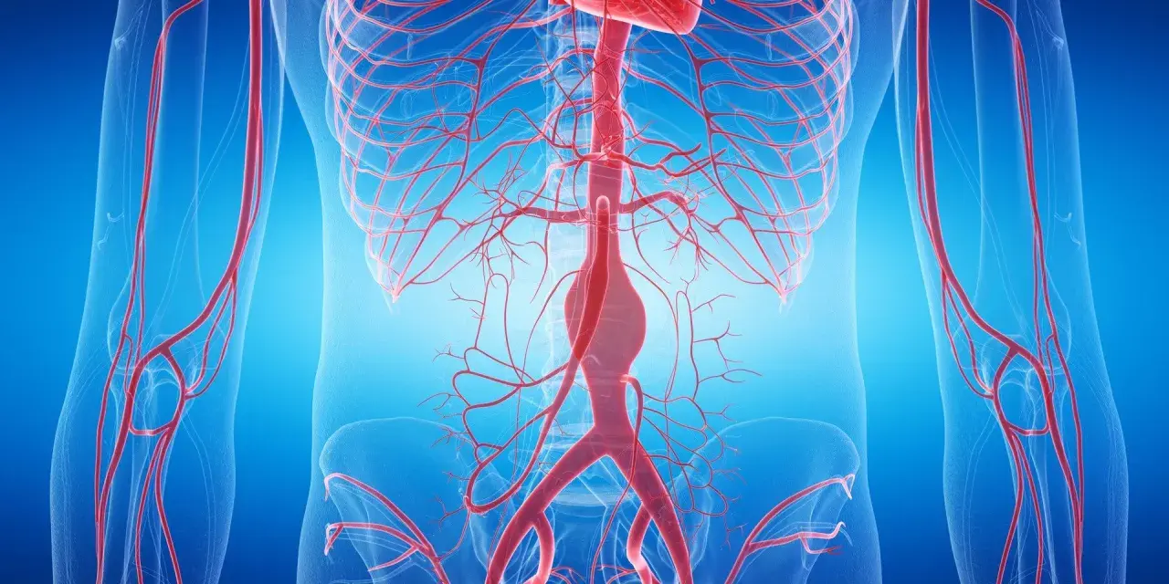 Anatomia aorty brzusznej z widocznym tętniakiem.