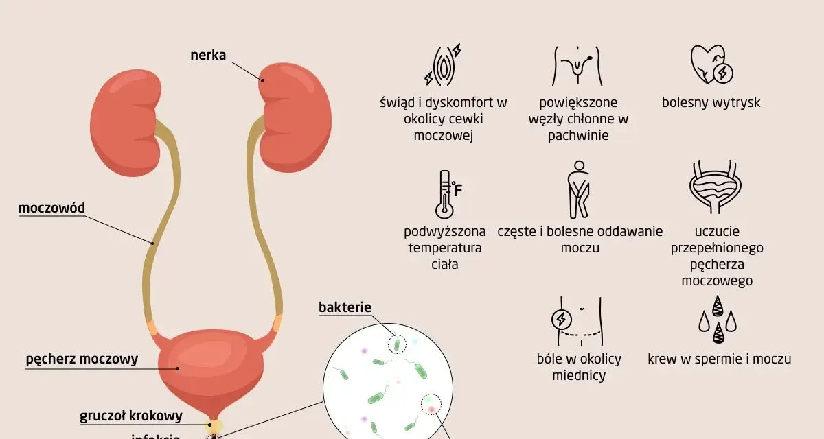 Ilustracja układu moczowego z nerkami, pęcherzem, cewką moczową i objawami zapalenia.