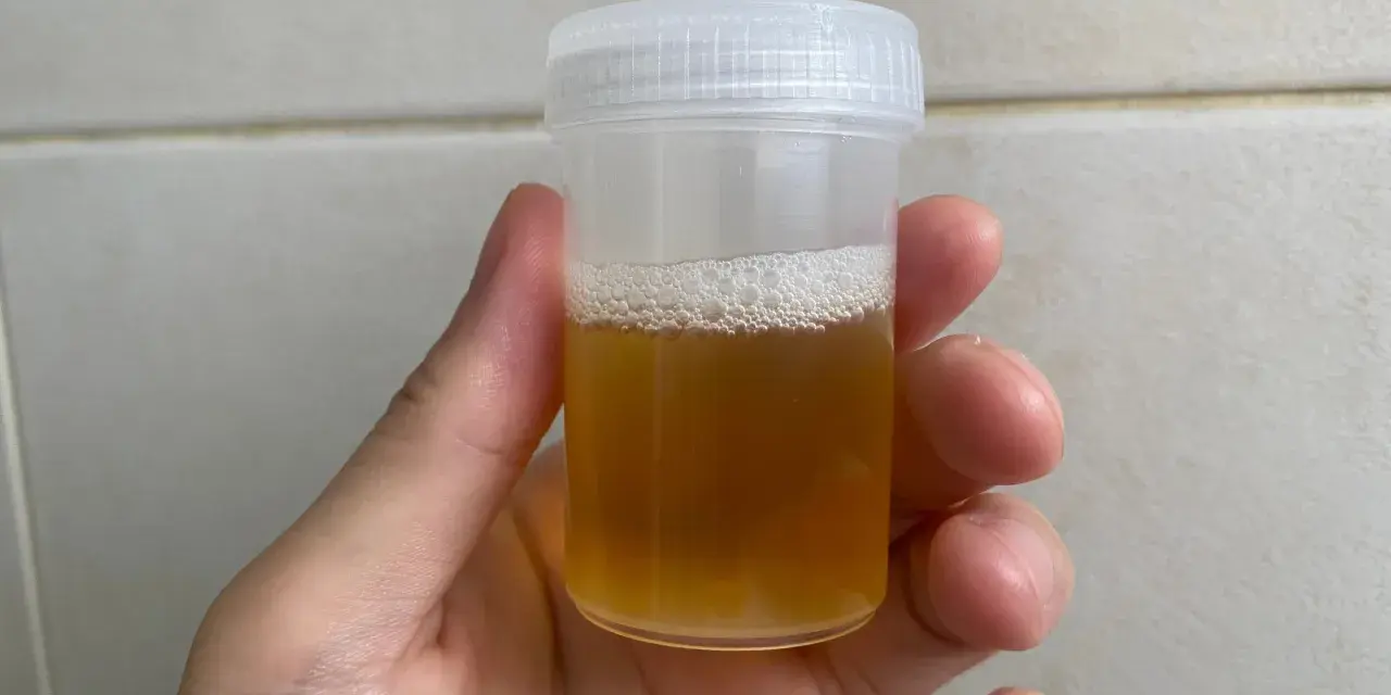 Dłoń trzymająca plastikowy pojemnik z żółtym płynem i pianą na wierzchu.