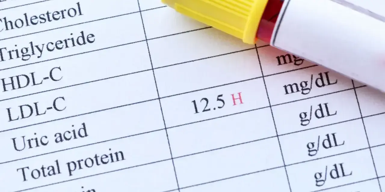 Wynik badania kwas moczowy: 12.5 H. Obok probówka z krwią.