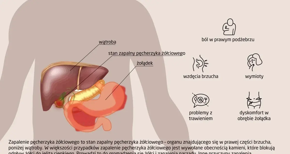 Ilustracja anatomiczna przedstawiająca wątrobę, pęcherzyk żółciowy i żołądek, z ikonami objawów zapalenia.