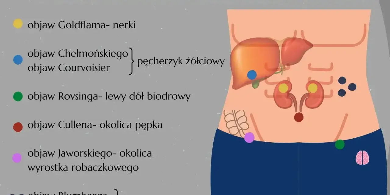 Ilustracja przedstawia schemat jamy brzusznej z zaznaczonymi organami i punktami odpowiadającymi objawom chorobowym.