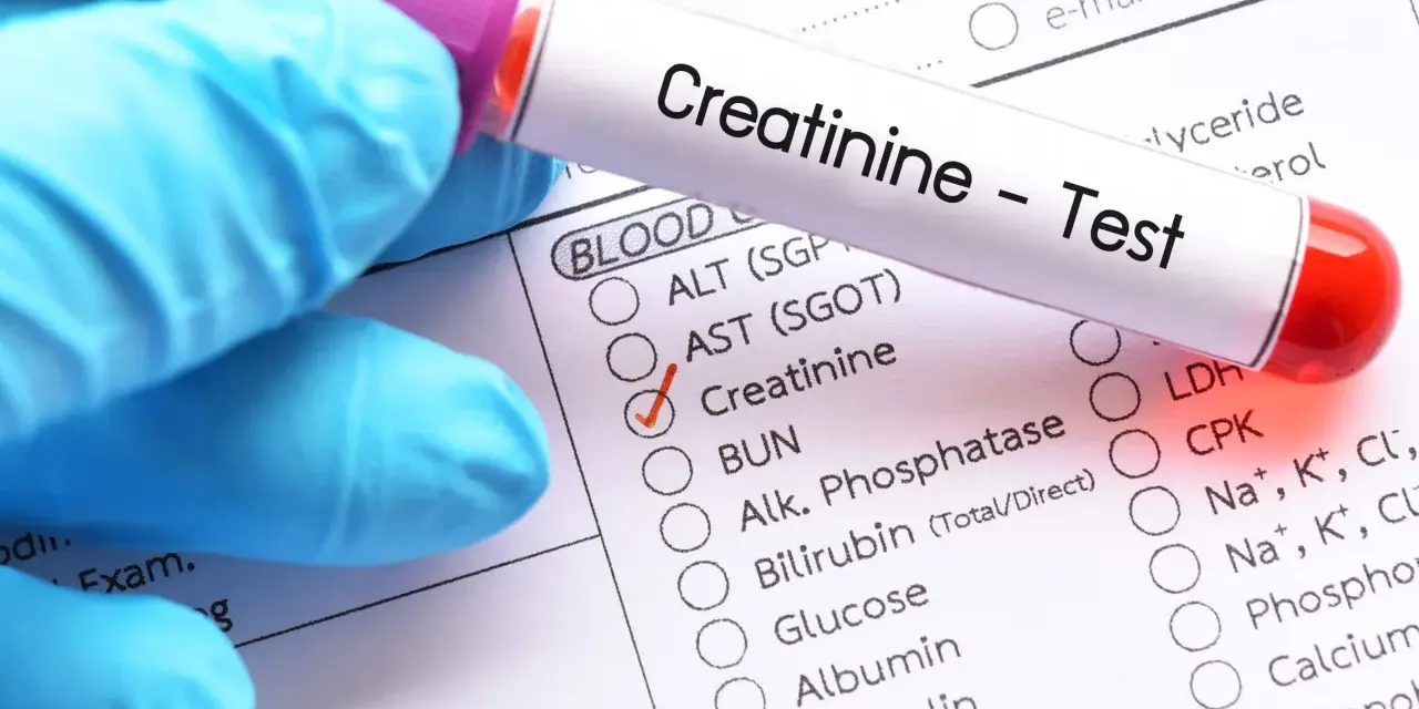 Rękawiczka w niebieskiej rękawiczce trzyma probówkę z napisem "Creatinine - Test". Zaznaczono pole "Creatinine", sugerując niski poziom kreatyniny.