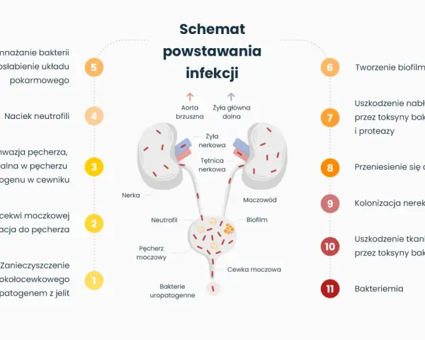 Schemat powstawania infekcji układu moczowego z zaznaczonymi nerkami, pęcherzem i cewką moczową.