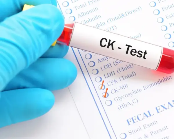 Ręka w niebieskiej rękawiczce trzyma probówkę z krwią do testu CK, czyli kinazy kreatynowej. Zaznaczono opcje CPK (Total) i CK-MB.