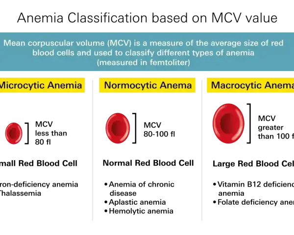 Porównanie wielkości krwinek czerwonych w anemii: mikrocytarna (małe), normocytarna (normalne) i makrocytarna (duże). MCV pomaga w diagnozie.