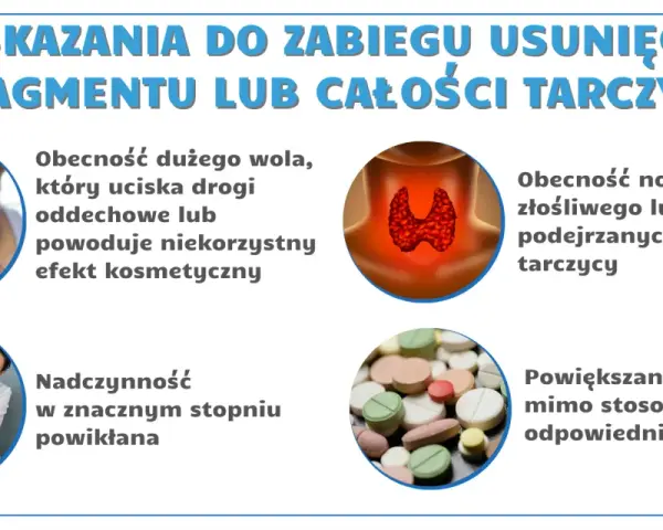 Ilustracja przedstawia schemat tarczycy, powiększone wole, lekarza badającego pacjentkę i tabletki.
