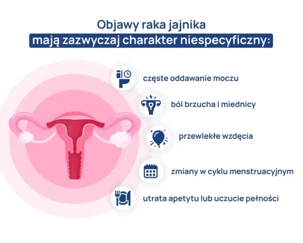 Objawy raka jajnika, które mogą być mylone z innymi dolegliwościami, to m.in. ból brzucha, wzdęcia, zmiany w cyklu menstruacyjnym.