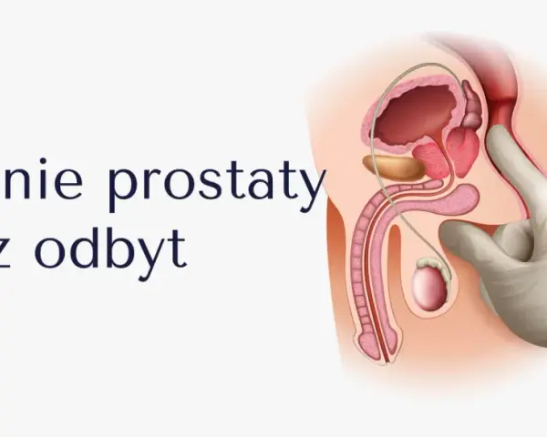 Ilustracja anatomiczna męskiego układu rozrodczego z palcem w rękawiczce badającym prostatę przez odbyt.