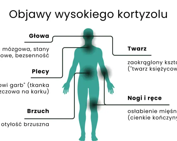 Ilustracja przedstawia sylwetkę człowieka z zaznaczonymi obszarami ciała i objawami wysokiego kortyzolu.