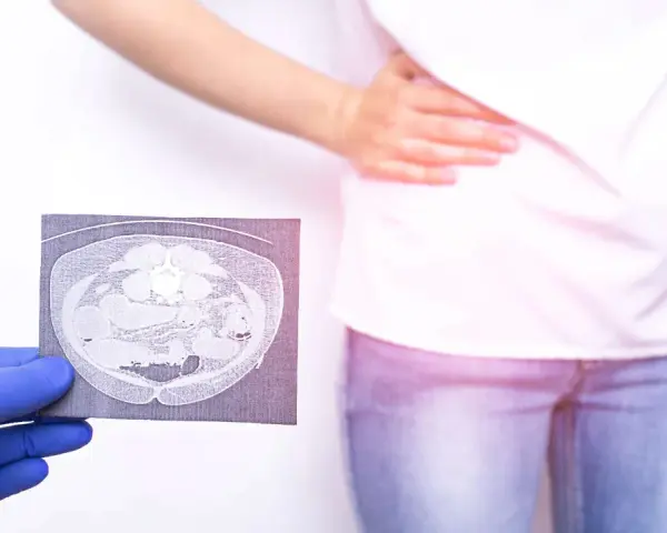 Lekarz w rękawiczce pokazuje tomografię jamy brzusznej osobie z bólem brzucha.