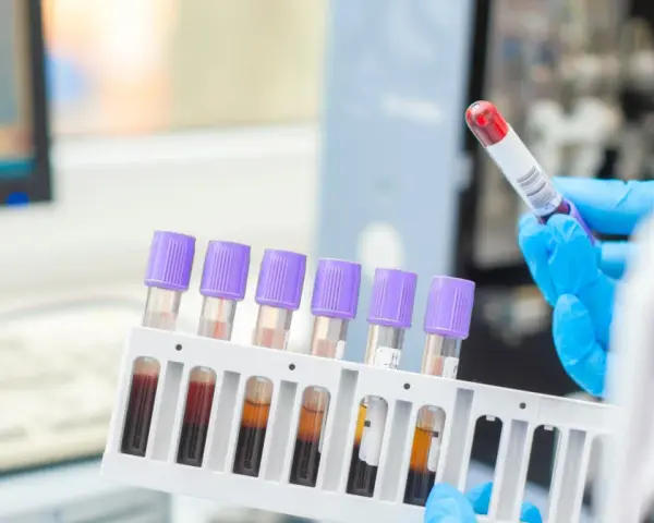 Ręce w niebieskich rękawiczkach trzymają probówki z krwią w stojaku, w tle sprzęt laboratoryjny.