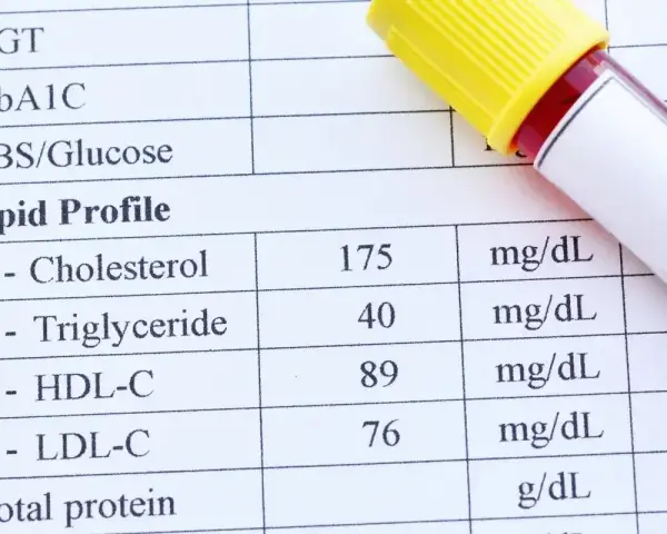 Wynik lipidogramu: cholesterol całkowity 175, triglicerydy 40, HDL-C 89, LDL-C 76. Wynik ten pomaga ocenić ryzyko chorób serca, analizując cholesterol nie-HDL.