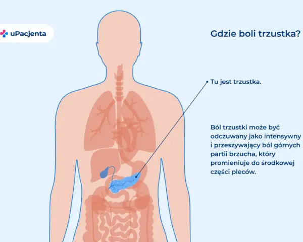 Ilustracja anatomiczna przedstawiająca ludzkie ciało z zaznaczoną trzustką i opisem bólu.