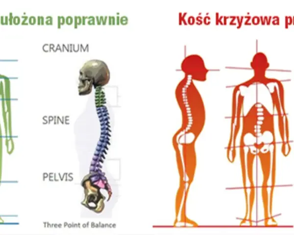 Prawidłowe ułożenie kości krzyżowej zapewnia stabilność kręgosłupa. Po prawej widać skrzywienie, gdzie kość krzyżowa jest przechylona.
