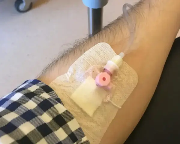 Ramię z wenflonem i plastrem, przygotowane do podania leku.